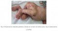 /album/fotogaleria/el-penfigo-jpg/